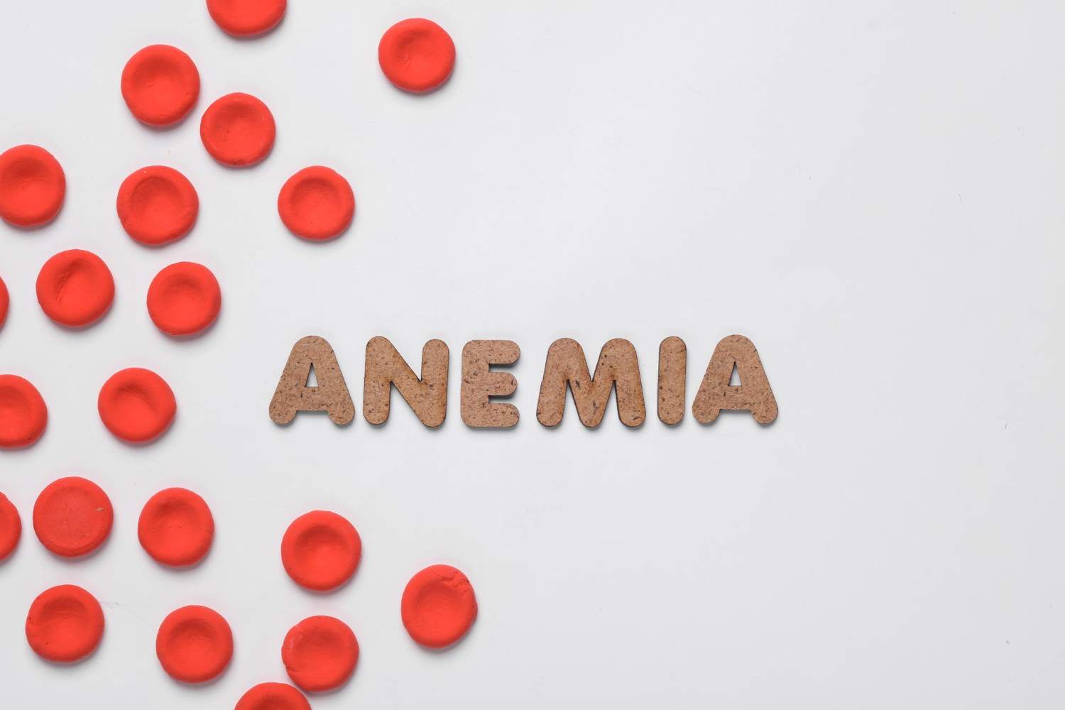 Anemie - Cauze, simptome, diagnostic și metode de tratament